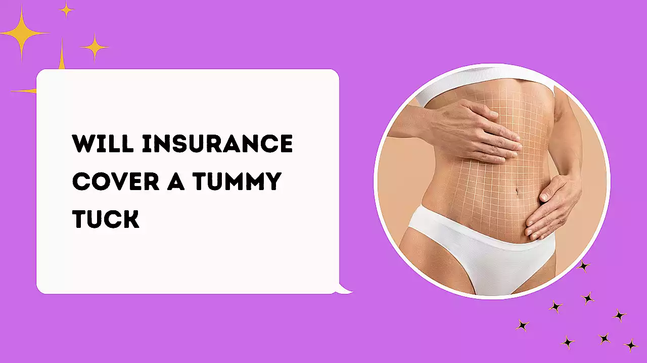 Will Insurance Cover a Tummy Tuck
